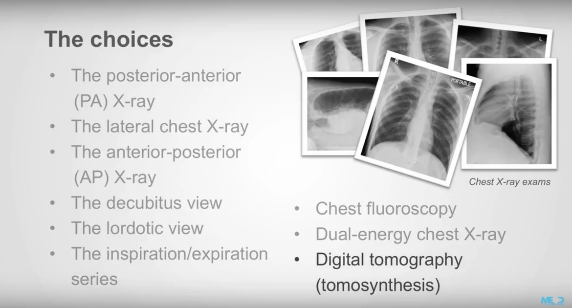 The different types of xray examinations Medmastery